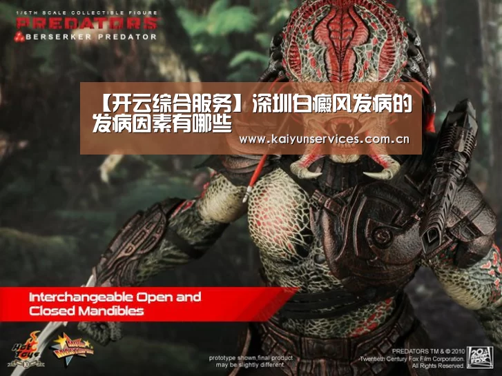 【开云综合服务】深圳白癜风发病的发病因素有哪些(图3) 开云品牌
